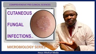 CUTANEOUS FUNGAL INFECTIONS Dermatophytoses [upl. by Navi]