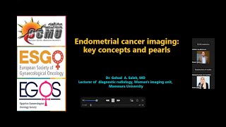 Endometrial cancer imaging Key concepts and pearls Dr Gehad Saleh [upl. by Naegem]