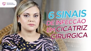 6 SINAIS DE INFECÇÃO EM CICATRIZ CIRÚRGICA  FALANDO COM A DRA VANESSA [upl. by Trahern103]