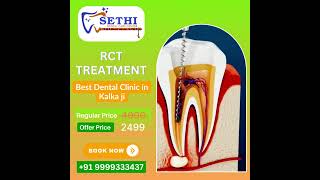 Sethi Dental Clinics special Independence Day offer on Root Canal Treatment RCT [upl. by Mireille]