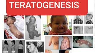 TERATOGENESIS Teratogenic agents and their effects on developing embryo [upl. by Almira]