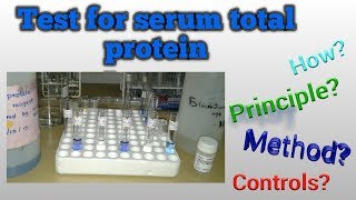 Serum protein test [upl. by Alliuqahs]