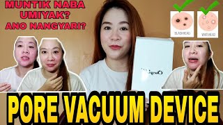 PORE VACUUM DEVICE HOW TO USE IT [upl. by Aivul599]