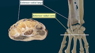 Músculos EXTENSORES RADIALES del CARPO  origen inserción función e inervación [upl. by Greenberg182]