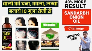 How To Use Sandarbh Onion Hair Oil Regrow Hair Stop Hair Fall And Prevent Premature Hair Greying [upl. by Norraa]