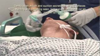 Intubation Extubation 67 [upl. by Reivaxe]