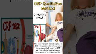 Procedure of CRP testwhat is CRP testlabtech viral shortfeed [upl. by Shaina]