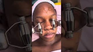 ACNE FACIAL😨😱youtube skincare facial youtubevideos viralvideo skintreatment acnescars [upl. by Sax]