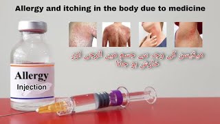 Medicine ki waja se Jism Par Kharish Ilagy hojana Urdu Psoriasis Treatment Chambal Ka Ilaj Urdu [upl. by Ahsienyt889]