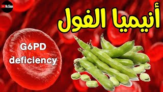 G6PD deficiency انيميا الفول favism 🫛🫘 [upl. by Marylinda]