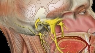 Neuralgia do Trigêmeo  Dores na Face Tratamentos para Nevralgia do Nervo Trigêmeo [upl. by Eilrebma662]