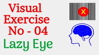 Lazy Eye Exercise 4 Amblyopia amp Strabismus। Best Eye Exercise [upl. by Noswad48]