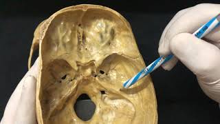 Skull Osteology  Cranial Cavity Anatomy [upl. by Notirb560]