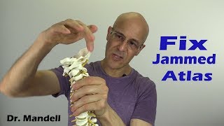 Hard Time Turning Your Neck Heres How to Fix It  Dr Alan Mandell DC [upl. by Eimilb]