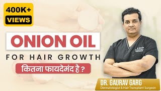 🧅Onion Oil for Hair Growth in Hindi  डॉ से जानिए Onion Oil Hair Loss में कितना फायदेमंद है [upl. by Derfliw]