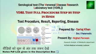 vdrl test principal and full procedure  Vdrl disease serological test in laboratory  vdrl test mlt [upl. by Wickman]