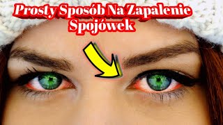 1901 Prosty Sposób Na Zapalenie Spojówek [upl. by Colline925]