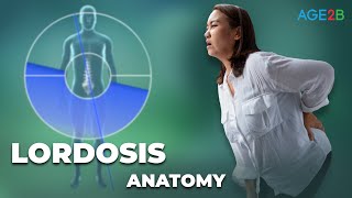 Fast Fix for Lumbar Lordosis  Overview Symptoms Causes Treatment Prevention And Diagnosis [upl. by Priest]