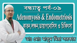 Adenomyosis এবং Endometriosis এর কারনলক্ষনডায়াগনোসিস ও চিকিৎসা [upl. by Anilejna]