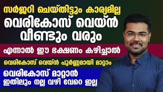 ഈ ഭക്ഷണം കഴിച്ചാൽ വെരികോസ് വെയ്ൻ പൂർണ്ണമായി മാറ്റാം varicose vein malayalam [upl. by Fara]