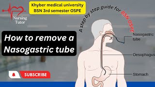 How To Remove An Ng Tube  The Removal Procedure  A Guide For Ospe And Osce [upl. by Voletta]