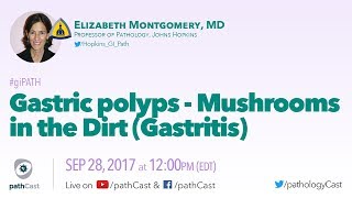 Gastric polyps  Mushrooms in the dirt GASTRITIS [upl. by Assehc]