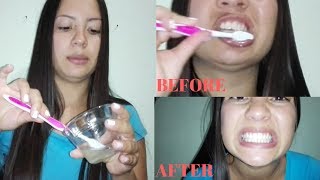 como blanquear los dientes con bicarbonato y limon en 2 minutos [upl. by Novyert265]