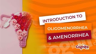 Introduction to Oligomenorrhea amp Amenorrhea  MCCQE1 [upl. by Eelam931]