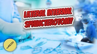 Lateral internal sphincterotomy  Everything Surgeries ✅😬⁉️ [upl. by Ashlin]