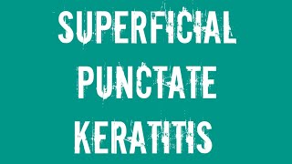 Ophthalmology Superficial punctate keratitis [upl. by Aleemaj]