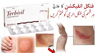 Terbisil 250mg Tablet Uses Benefits amp Side Effects in Urdu Hindi  Drug Medicines [upl. by Piefer]