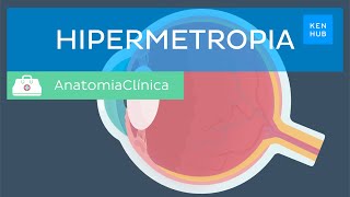 Hipermetropia Definição causas sintomas diagnóstico e tratamento  Kenhub [upl. by Adleremse]