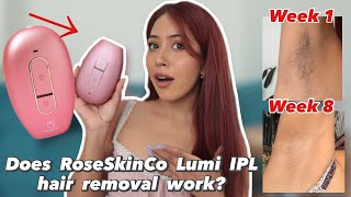 I tried IPL hair removal at home BeforeAfter Results [upl. by Amasa458]