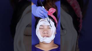 hydrafacial hydra hydrafacialtreatment chennai best skincare shorts beauty link 😘🥰🤗👇🏽 [upl. by Angeline662]