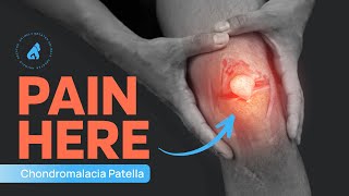 Chondromalacia Patellae  Runner’s Knee  Knee Pain Exercises  Knee Cap Pain [upl. by Dlawso]