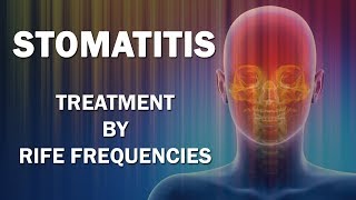 Stomatitis  RIFE Frequencies Treatment  Energy amp Quantum Medicine with Bioresonance [upl. by Nylesor]