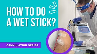 How to do a WET STICK Dialysis Cannulation [upl. by Palua]