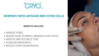 SkinPen® with AnteAGE MD® Stem Cells PROHEALING AND ANTIINFLAMMATORY SERUM [upl. by Atileda955]