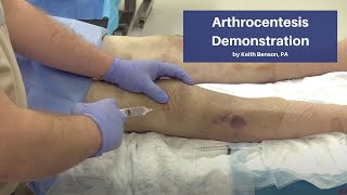 Arthrocentesis Demonstration  The CadaverBased EM Procedures SelfStudy Course [upl. by Calder683]