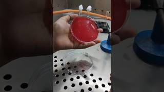 How To Streak For Blood Agar Plates Bacterial Streaking Technique [upl. by Ardnak]