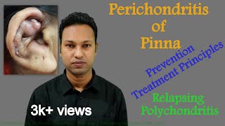 Perichondritis of Pinna Prevention amp Treatment। Difference with Relapsing Polychondritis [upl. by Mavilia]