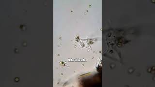 Amebas tentam se juntar e formar uma MEGA AMEBA microorganismos microbiologia curiosidades [upl. by Anilegnave]