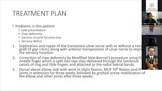 Plastiquest Case Discussion Ulnar Nerve Palsy Part 2 [upl. by Nayrbo]