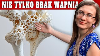 Zahamuj Rozwój Osteoporozy Tymi Sposobami [upl. by Eilahs]