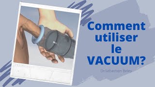 Dr Sébastien Beley Comment utiliser le vacuum [upl. by Steve]