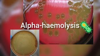 αhaemolysis streptococcus bacteria microbiology [upl. by Lovash39]