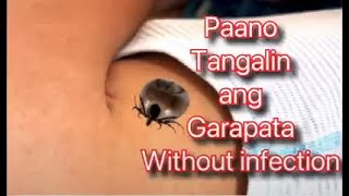 Paano Tanggalin ang Garapata sa Balat WITHOUT INFECTION  Garapata sa Bata  Garapata [upl. by Godbeare]