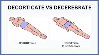 Decrebrate amp Decorticate Rigidity [upl. by Gaelan308]