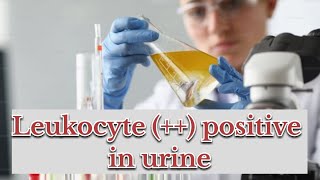 leukocytes positive in urine  symptoms causes  treatment [upl. by Kent]