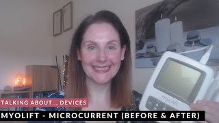 Myolift Microcurrent Device  Before amp After 30 Uses [upl. by Elyk]